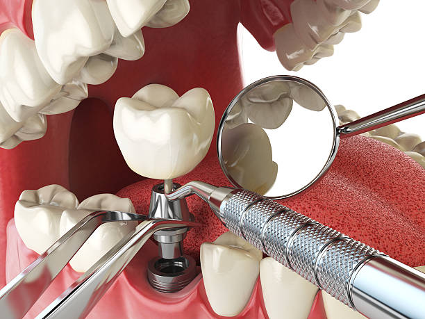 Best Urgent Tooth Repair  in Turley, OK